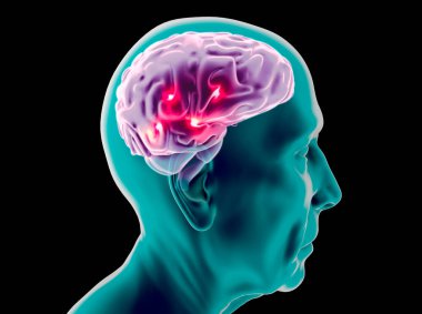Yaşlı bir adamın beyninin yan görüntüsü. Nöronlar ve sinapslar. İletişim ve serebral uyarıcılar. Nöral ağ devresi, dejeneratif hastalıklar, Parkinson, Alzheimer. 3d hazırlayıcı