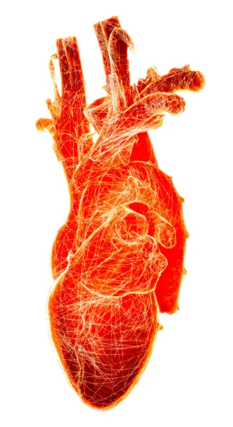 Studio Anatomico Cuore Problemi Cardiaci Infarto Chirurgia Resa Silhouette Cuore — Foto Stock