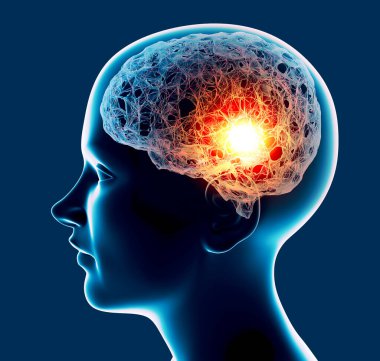 Baş ağrısı, beyin ve sinapslar, bilişsel sorunlar, zihinsel bozukluklar. Anevrizma. Beyin bölgesini etkileyen dejeneratif hastalıklar. Parkinson ve Alzheimer. İnsan anatomisi ve beyni. 3d hazırlayıcı