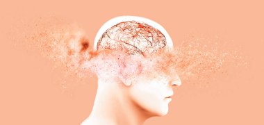 Hafıza kayıpları, bazı şeyleri unutmak, dejeneratif hastalıklar. Beyin sorunları. Parkinson ve Alzheimer hastalığı. Akıl sağlığı. Felç, sinapslar ve nöronların etkileşimi. 3d hazırlayıcı 