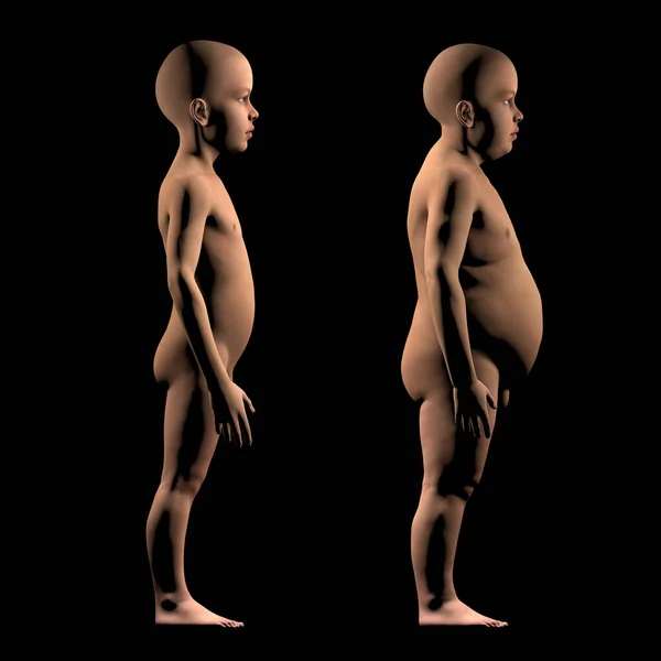 Niño Tamaño Normal Niño Obeso Comparación Problemas Obesidad Niños Dieta — Foto de Stock