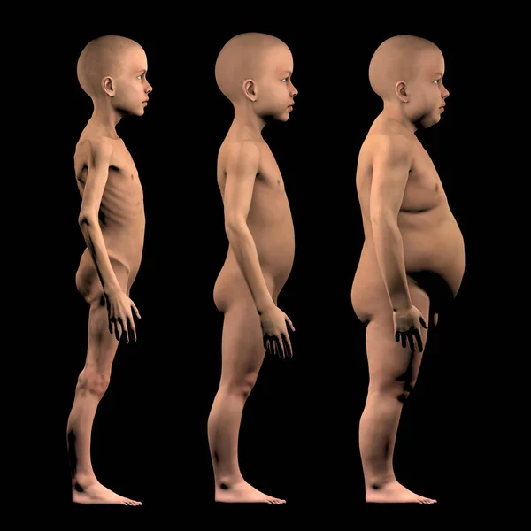 栄養失調の子供 通常のビルドと肥満の子供と比較して 子供の食糧不足と肥満の問題 3Dレンダリング — ストック写真