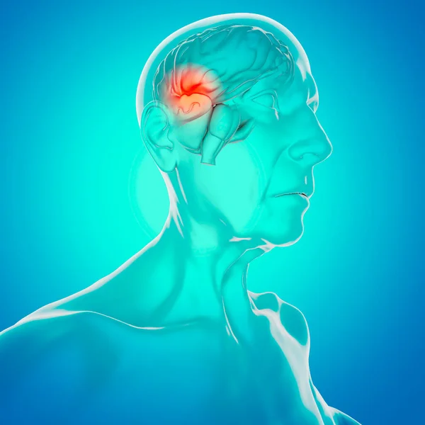 Widok Boczny Mózgu Starszego Mężczyzny Nowotwór Neurony Synapsy Choroby Zwyrodnieniowe — Zdjęcie stockowe