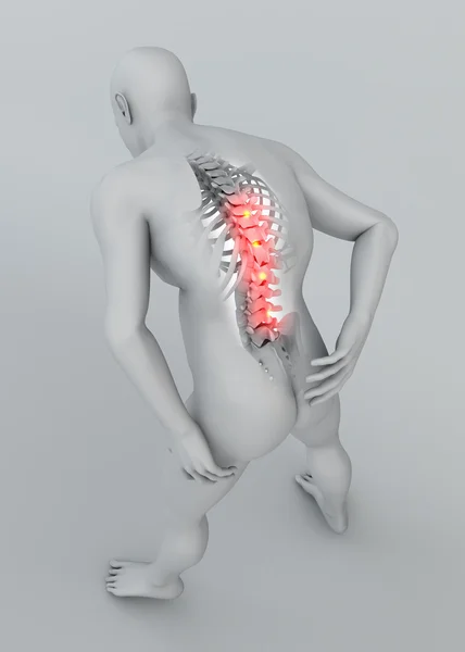 Man seen from behind with pain in spine — Stock Photo, Image