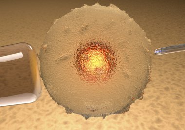 Ovum, suni tohumlama