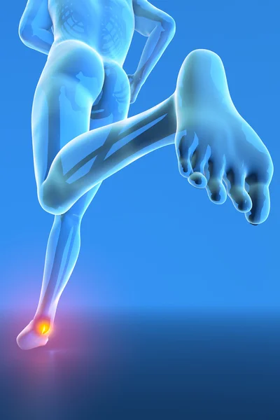 Sprained ankle blue x-ray — Stock Photo, Image