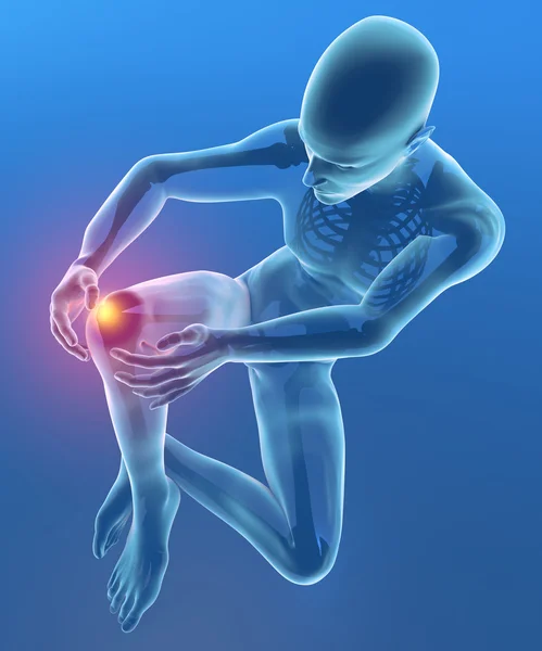 Człowiek z ból w kolanie — Zdjęcie stockowe