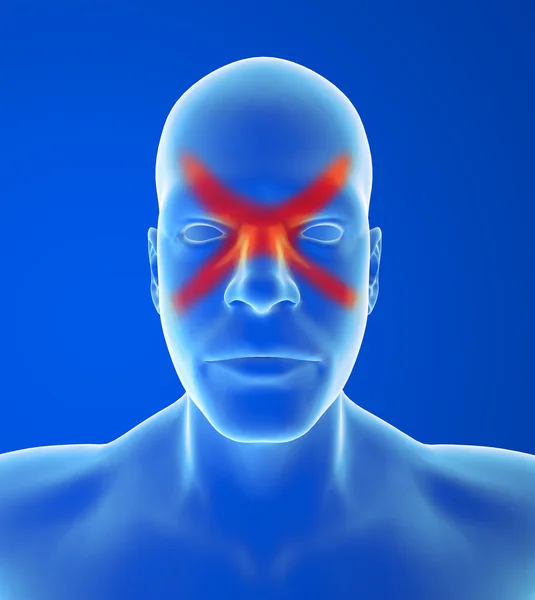 Sinus headache — Stock Photo, Image