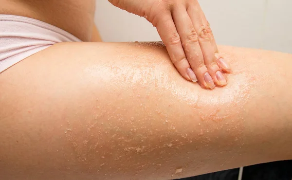Ramen Skrubbar Flickans Hand Huden Låret Med Salt För Massage — Stockfoto