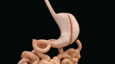 Biliopancreativ Diversion with Switch -- 3D Rendering