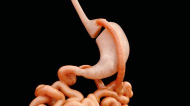 Roux en Y Gastric Bypass -- 3D Rendering