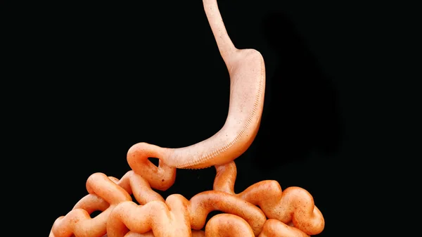 Vertical Sleeve Gastrectomy Vsg Rendering — Φωτογραφία Αρχείου