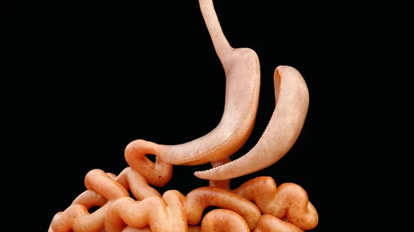 Vertical Sleeve Gastrectomy Vsg Renderowanie — Zdjęcie stockowe