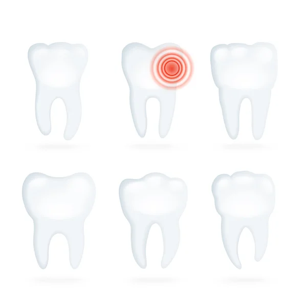 Zestaw sześciu zębów — Wektor stockowy