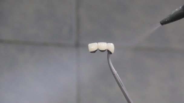 Behandling av tandkronor med ånga — Stockvideo