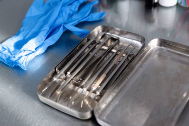 Diş aletleri ve tıbbi eldivenler masada.