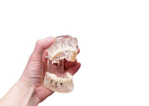 Mock up maxilar com os dentes segura na mão sobre fundo branco — Fotografia de Stock
