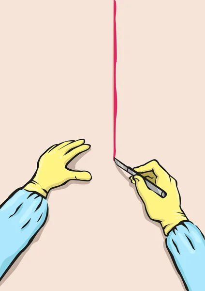 Concept d'opération avec les mains à l'aide d'un scalpel. Clip art modifiable . — Image vectorielle