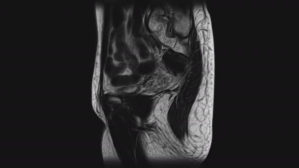 MRI besar dari organ panggul perempuan, rongga perut, saluran pencernaan dan kandung kemih — Stok Video