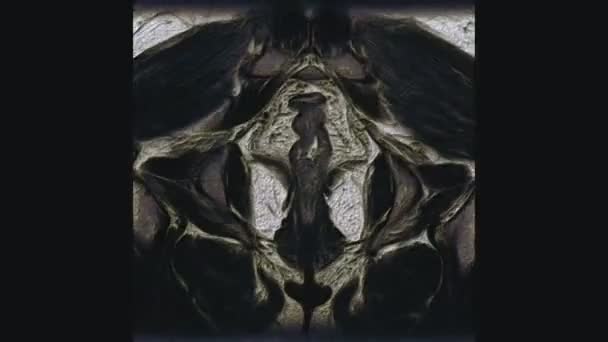 Resonancia magnética de color voluminoso de los órganos pélvicos femeninos, cavidad abdominal, tracto gastrointestinal y vejiga — Vídeo de stock