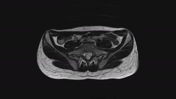 Об'ємна МРТ органів малого тазу, черевної порожнини, шлунково-кишкового тракту та сечового міхура — стокове відео