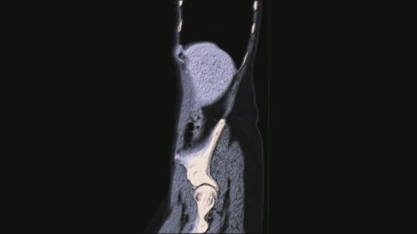 Couleur volumineuse IRM des organes pelviens féminins, cavité abdominale, tractus gastro-intestinal et la vessie — Video