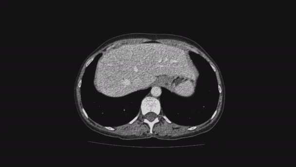 Objętościowe MRI żeńskich narządów miednicy, jamy brzusznej, przewodu pokarmowego i pęcherza moczowego — Wideo stockowe