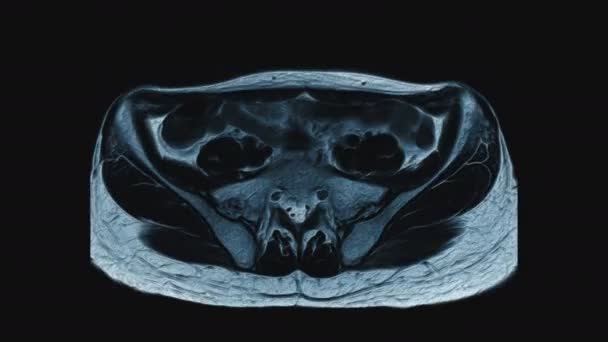 여성의 골반, 복강, 위장관 및 방광을 보여 주는 휘황찬란 한 색깔 MRI — 비디오