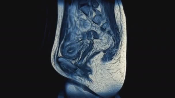 Voluminous color MRI of the female pelvic organs, abdominal cavity, gastrointestinal tract and bladder — Stock Footage Voluminous color MRI of the female pelvic organs, abdominal cavity, gastrointestinal tract and bladder Stock Footage