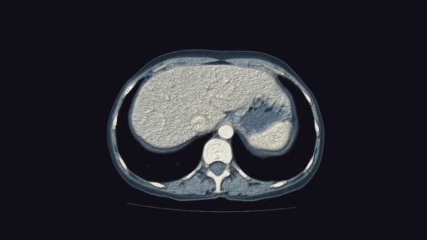Volumineuze kleur MRI van de vrouwelijke bekkenorganen, buikholte, maagdarmkanaal en blaas — Stockvideo