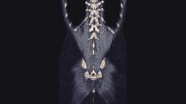 Objętościowy kolor MRI żeńskich narządów miednicy, jamy brzusznej, przewodu pokarmowego i pęcherza moczowego — Wideo stockowe