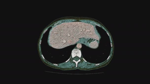 Massenhaft mehrfarbige MRT der weiblichen Beckenorgane, der Bauchhöhle, des Magen-Darm-Traktes und der Blase — Stockvideo