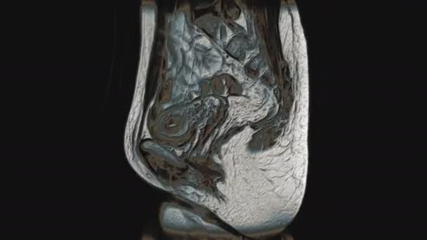 Massenhaft mehrfarbige MRT der weiblichen Beckenorgane, der Bauchhöhle, des Magen-Darm-Traktes und der Blase — Stockvideo