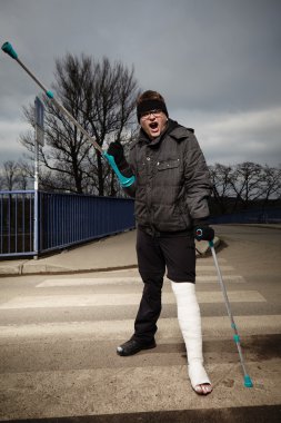 Nefret ediyorum bu alçı