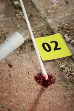 Suç mahallinde Dna testi için kan örneği