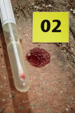 Dna testi için kan toplama