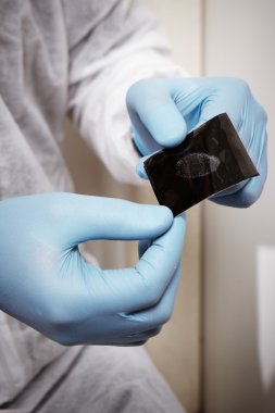 Fingerprint lifted on gel tape