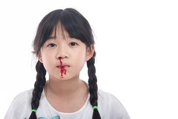 Asiática chica con sangrado de la nariz — Foto de Stock