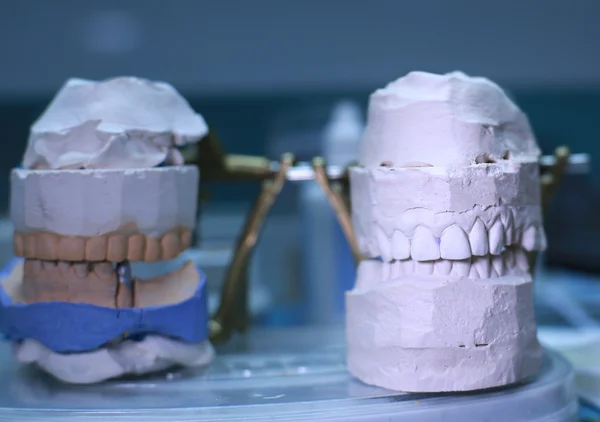 Зубний протез — стокове фото