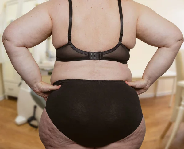 Donna Con Obesità Cellulite Una Sala Trattamento Con Medico — Foto Stock