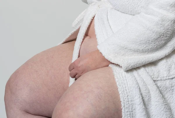 Obesity Cellulite Model Woman Photoshoot Subject Diet — Stock Photo, Image