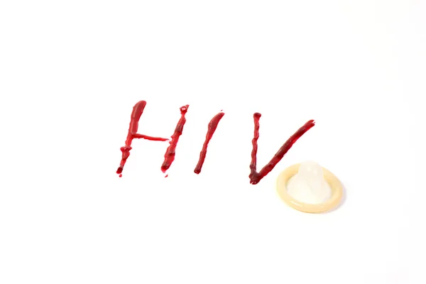 HIV Aids diagnóza — Stock fotografie