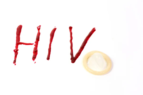 Диагноз ВИЧ / СПИД — стоковое фото
