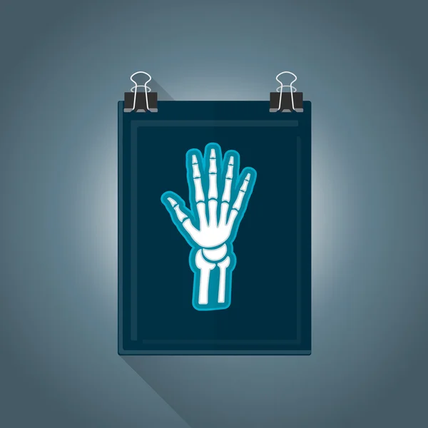 Vecteur plat radiographie illustration ico — Image vectorielle