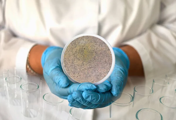 Tıbbi elbise ve eldiven giymiş bir kız, yuvarlak bir çerçevede mikroskoptan Candie Albicans 'ın fotoğrafını tutuyor..