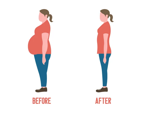 Mulheres de forma corporal antes e depois da perda de peso —  Vetores de Stock