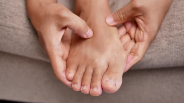 Closeup Female Holding Her Painful Feet Massaging Her Bunion Toes — Stok Video