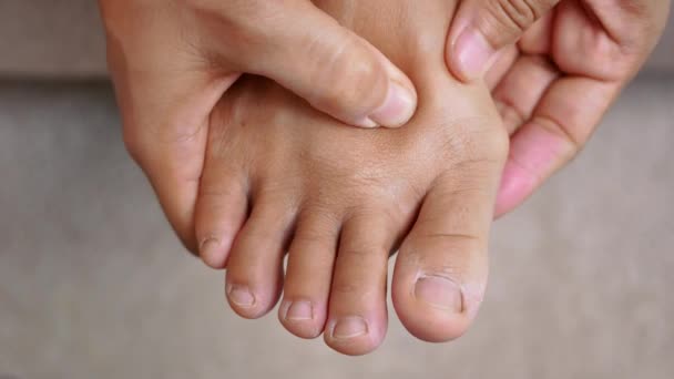 Closeup Female Holding Her Painful Feet Massaging Her Bunion Toes — Stock Video