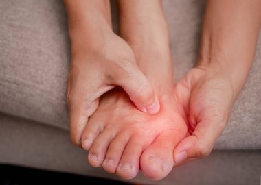 Closeup of female holding her painful feet and massaging her bunion toes to relieve pain. Swollen bunion at the edge of the big toe causes deformity (Hallux valgus). Woman's health concept. clipart