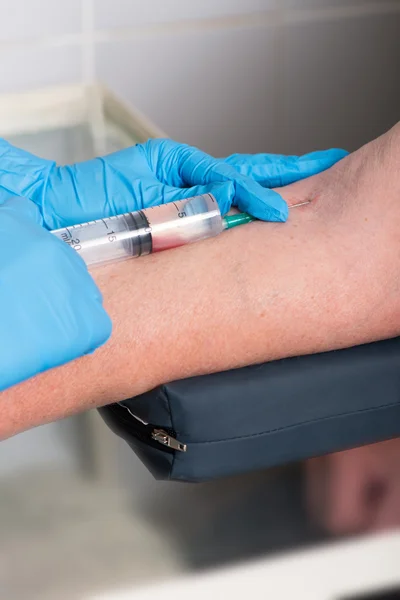 Hands in rubber medical gloves do an injection in a vein — Stock Photo, Image